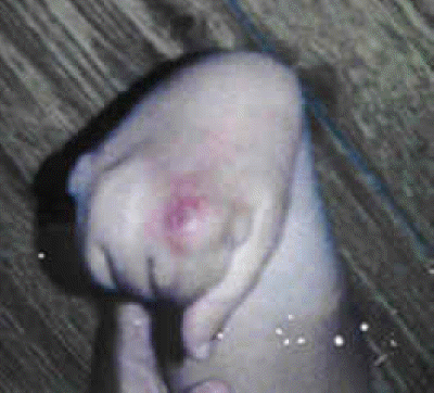 db_Hand_Deformity_Pic_-3_copy1