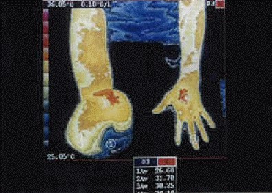 db_Thermography_Pic_-1_copy2