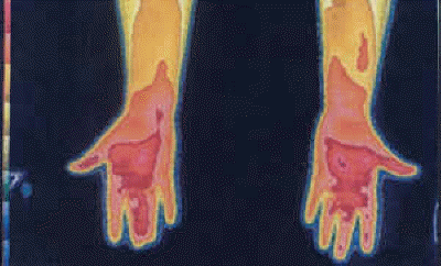 db_Vert-Symp_Thermo_copy1