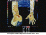 Thermography Picture #1