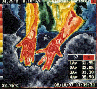 Thermography Picture #2 